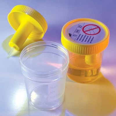 Urine Collection Cup with Integrated Transfer Device